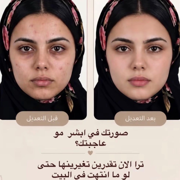 تعديل صور الاحوال غير مستعجل 